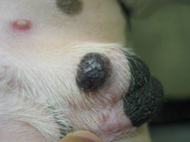 Tumor Melanocitico - Pele e Dedos